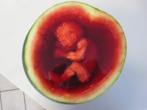 watermelon_fetus